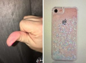 Beware of shiny iPhone cover causes chemical burns